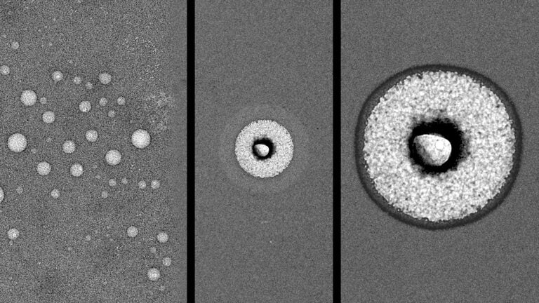 TEM imaging